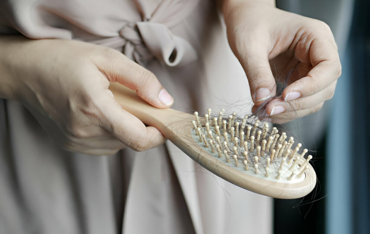درمان ریزش مو در زنان با هورمون‌تراپی