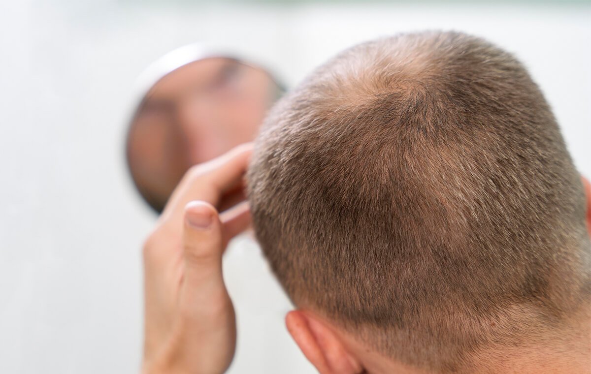 روش‌های پی آر پی مو چیست؟